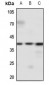 Anti-EDG2 Antibody